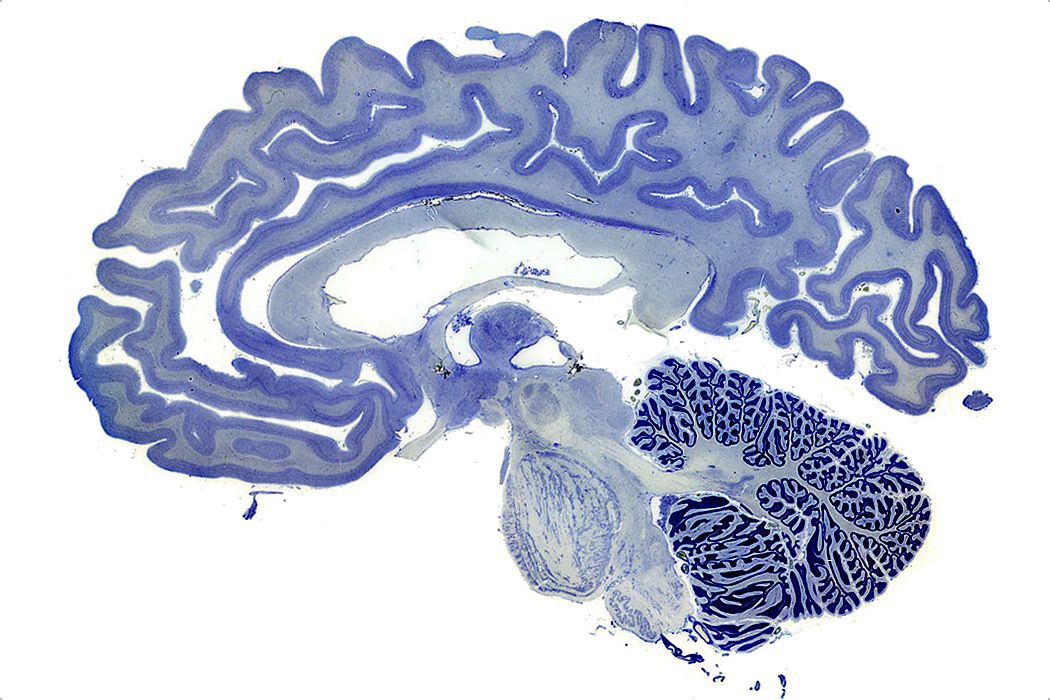 yep, that's what's inside your head!